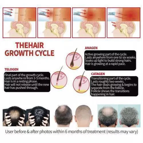 Red Light Therapy Hat 650nm&850nm Hair Loss Treatment Cap Hair Growth Regrowth - Picture 6 of 13