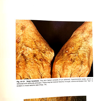 Dermatology In General Medicine Atlas Third Edition 2 Books Hardcover 1987