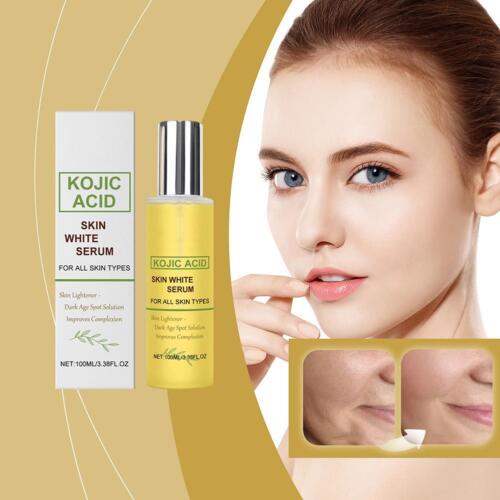 KOJIKOJIC ACID Skin Whitening Brightening Serum Bleaching/Spot Fade Cream - Picture 12 of 14