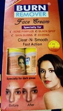 Face Cream treatment for acne, pimples, black spots, skin burns, eczema 50g