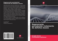 Anagha Gawai (U. A.) | RegeneraçãO Periodontal: Tratamento De Defeitos óSseos