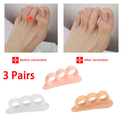 3 Paar weiche Klaue Hammer Fuß Zehen Gel Pad Trenner Crest Glätteisen Dehner -
