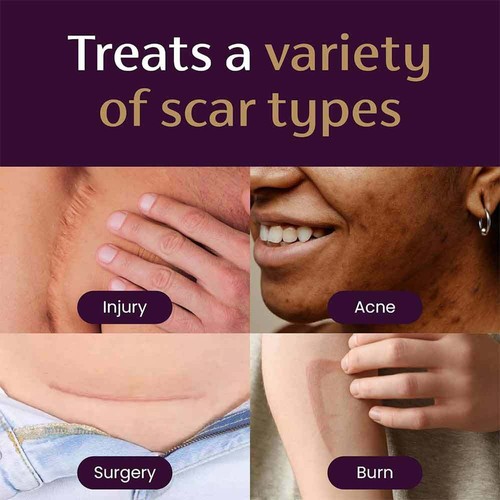 Mederma Advanced Scar Gel Cream Treatment Skin Care Old & New Scars - 50g Hot - Picture 3 of 10