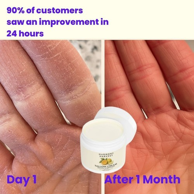 #ad #ad Natural Hand Healing Dry Skin Rescue Chemical Free Moisture Natural Balm $28.00