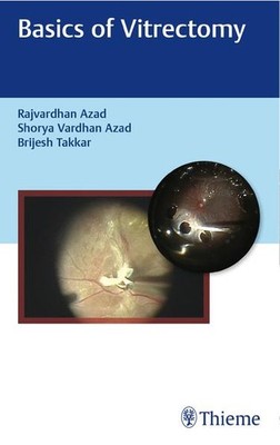 Basics of Vitrectomy | englisch