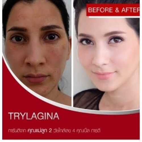4x TRYLAGINA Ultimate Collagen 12X Serum 1Moisturizing Aura Skin Anti-Wrinkle - Picture 16 of 19