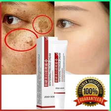 Effective Whitening Freckle Cream Remove Dark Spot Cream Removal Melanin Melasma