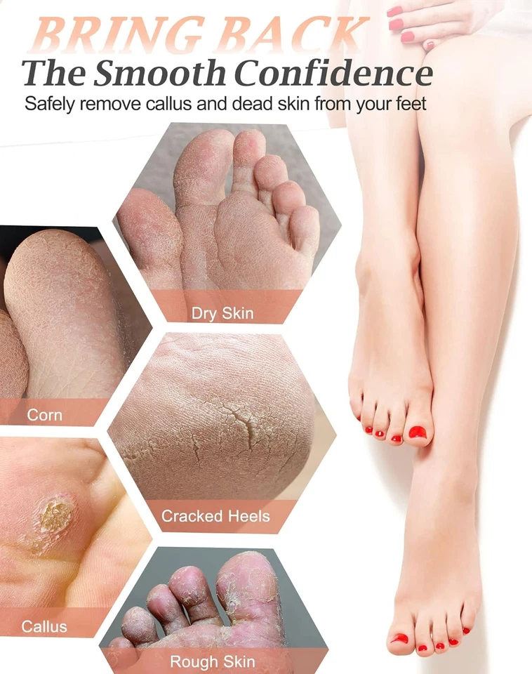 Piedra pómez natural para pies - Exfoliante exfoliante para pedicura, 1 unidad Foto 3 de 4