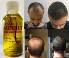 100 Organic Batana Oil from Honduras, natural hair growth 3.4 fl.oz/100ml US FS