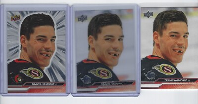 Travis Hamonic 23-24 UD Extended Base & Clear Cut & Outburst Silver #595 Ottawa