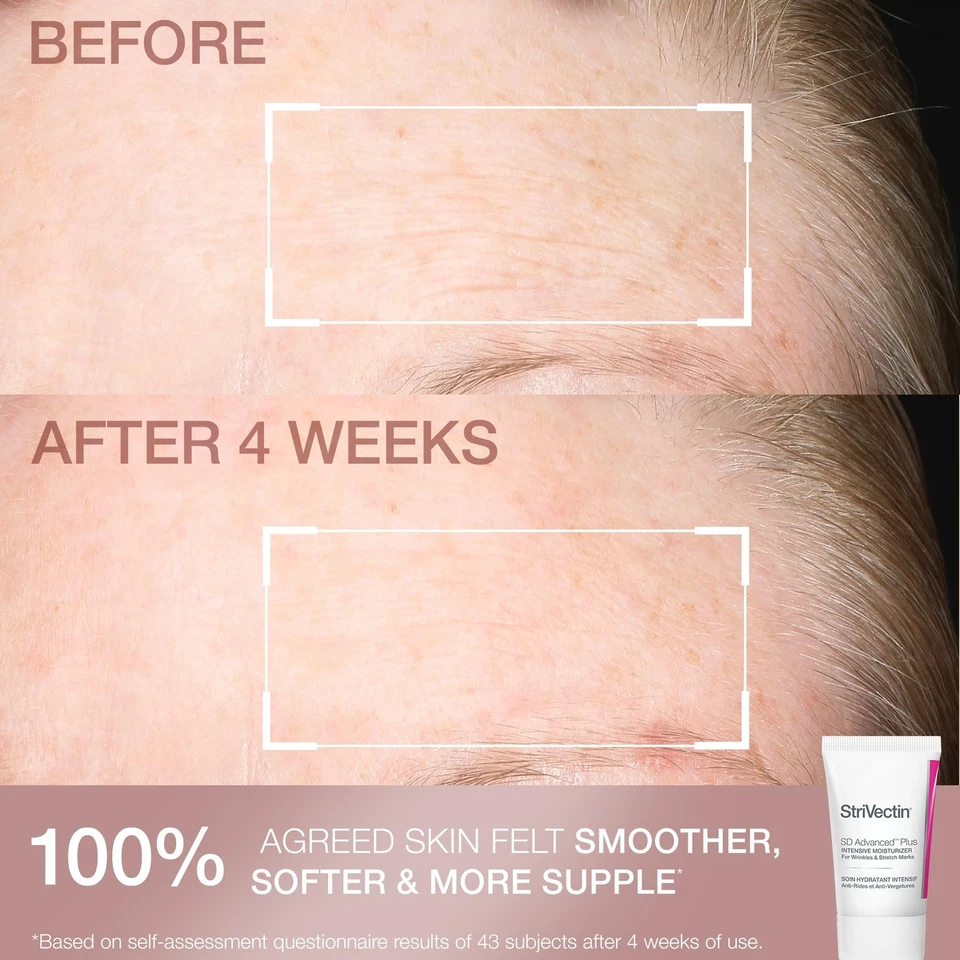 StriVectin Smooth Hydrate Face Moisturizer and Eye Cream Skin Care 2-Piece Set - Image 4 of 4