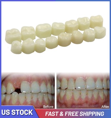 50/70Pcs Temporary Teeth Crowns Resin Posteriors Anterior Molar Tooth Cap Dental