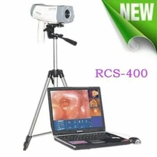 Carejoy Digital High accuracy Portable 480000 Pixels Electronic Colposcope