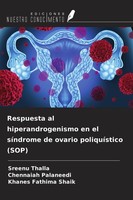 Respuesta Al Hiperandrogenismo En El SíNdrome De Ovario PoliquíStico (Sop) Chenn
