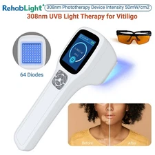 308nm Excimer Laser Therapy Professional Narrowband Device for Skin White Patche
