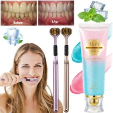 Niacinamide Whitening Toothpaste,Natural Niacinamide Toothpaste,Teeth Whitening