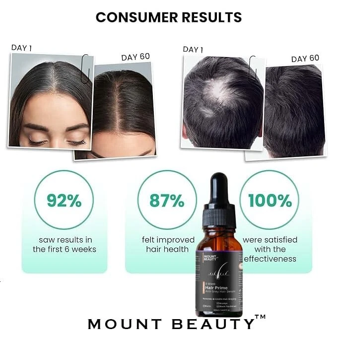 Grow Gorgeous Siero Original Crescita Capelli 90ml | Grow Gorgeous Grow Gorgeous Siero Original Crescita Capelli 90ml | Grow Gorgeous