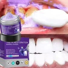 New Dental Restoration Mineral Powder, Mineral Tooth Powder, Teeth Whitening