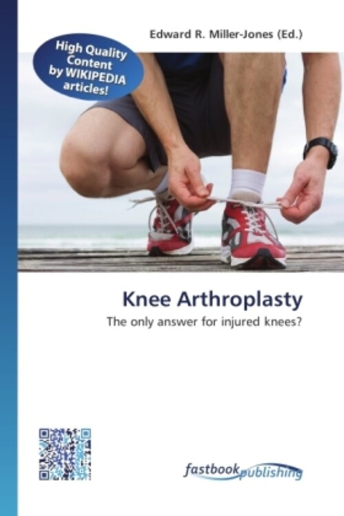 Edward R. Miller-jones | Knee Arthroplasty | Taschenbuch | Englisch