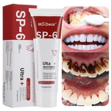 SP-6 Probiotic Whitening Toothpaste Refresh Mouth Brighten Removes Yellow Teeth