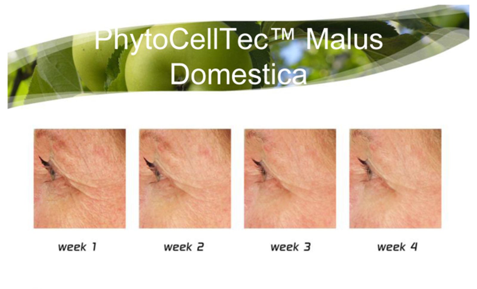 15m DIY 100% PhytoCellTec&trade;Apple Stem Cell Extract Serum Booster,Rebuild Collagen