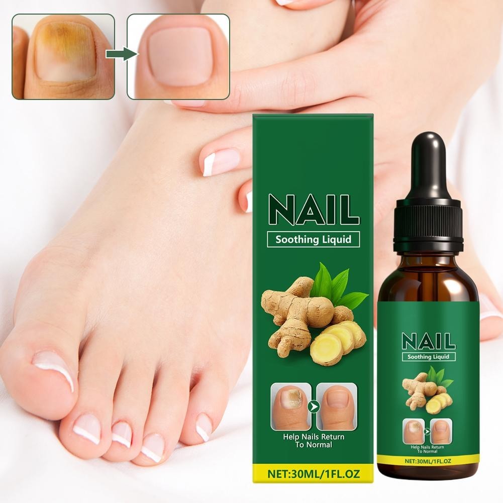 Ginger Nail Care Solution, Nail Soothing Liquid Help NEW Return Nails to Y2D1