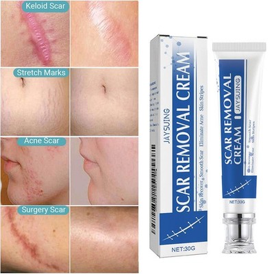 Scar and Acne Mark Removal Gel Ointment Remove Scars Burns Stretch Marks