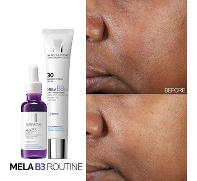 La Roche-Posay Mela B3 Serum 30ml + SPF 30 Dark Spot Brightner, 40ml [USA Stock]