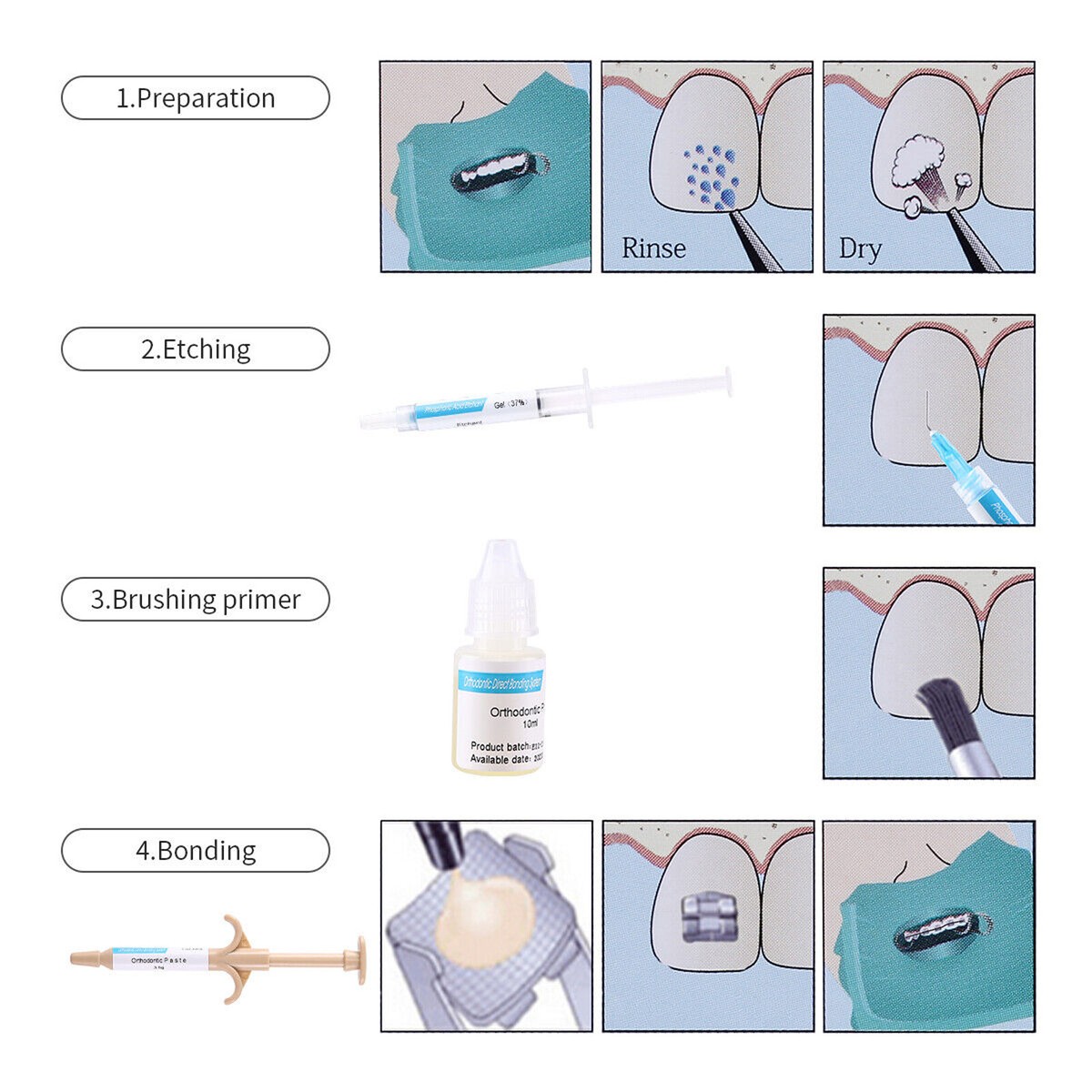 1 Kit Dental Orthodontic Use Adhesive & No-Mix Direct Bonding System USPS