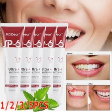 5/3X SP-6 Probiotic Toothpaste,Sp-6 Brightening Toothpaste Ultra Whitening Teeth