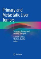 Shishir K. Maithel (U. A.) | Primary And Metastatic Liver Tumors | Taschenbuch