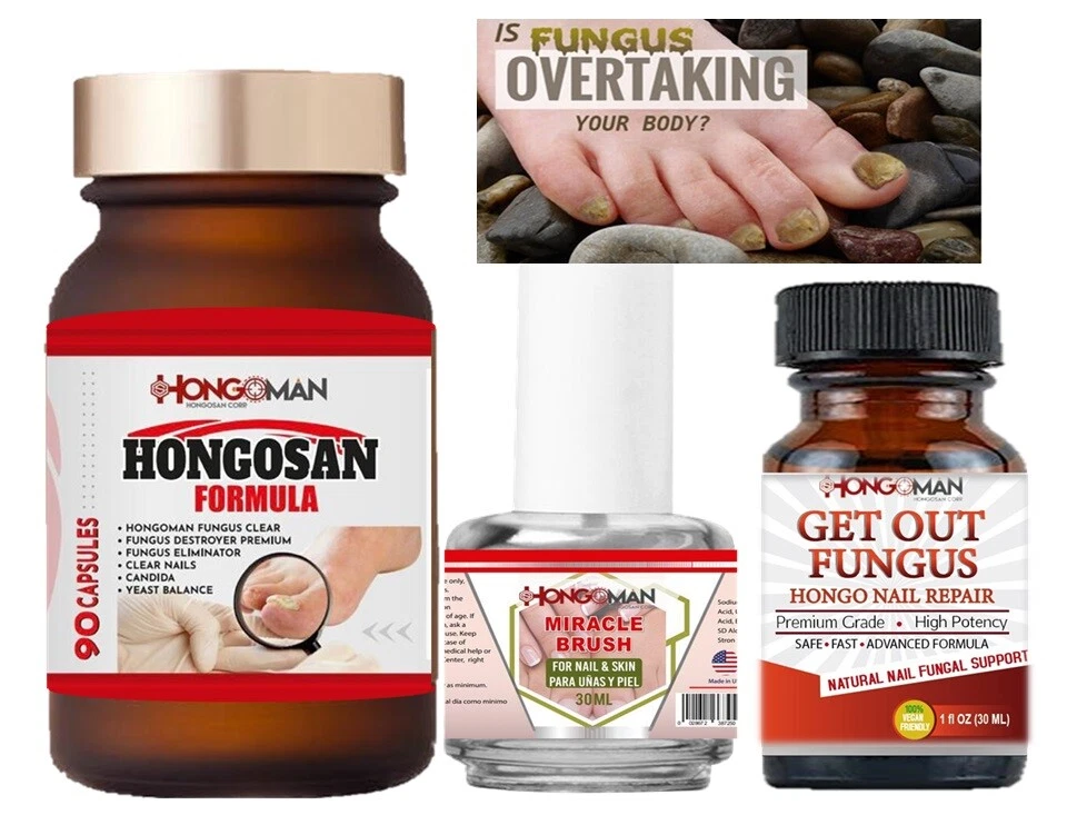 Arishine Fungus Treatment, Fungus Stop, Anti Fungus Nail Treatment