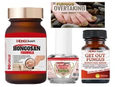 Kit Hongosan prevent fungus support athletes foot nail skin anti fungal  support
