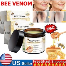 Bee Venom Skin Tag Removal Treatment Cream Body Care Mole Corn Wart Remover