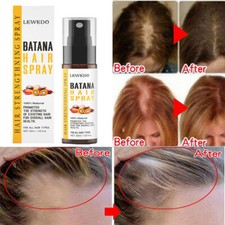 Natural Batana Oil Spray for Healthier  Thicker Hair Growth and Anti-hair Loss