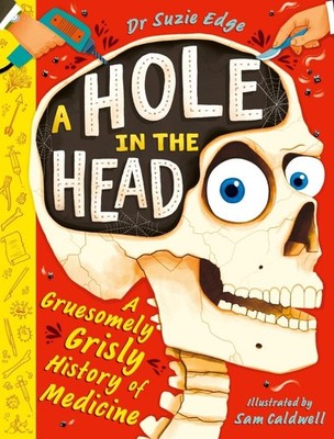 A Hole in the Head: A gruesomely grisly history of medical firsts by Suzie Edge