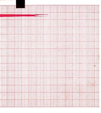 ECG Paper 90MMx70MMx400Sheets (Works for ESAOTE P80/SECA, CT300/M, PK 5