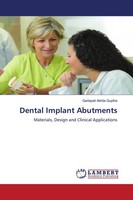 Garlapati Akhila Guptha | Dental Implant Abutments | Taschenbuch | Englisch