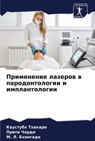 Primenenie Lazerow W Parodontologii I Implantologii Kaustubh Thakare (U. A.)