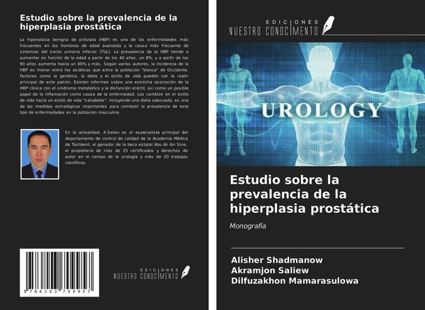 Estudio Sobre La Prevalencia De La Hiperplasia ProstáTica Dilfuzakhon Mamarasulo-image