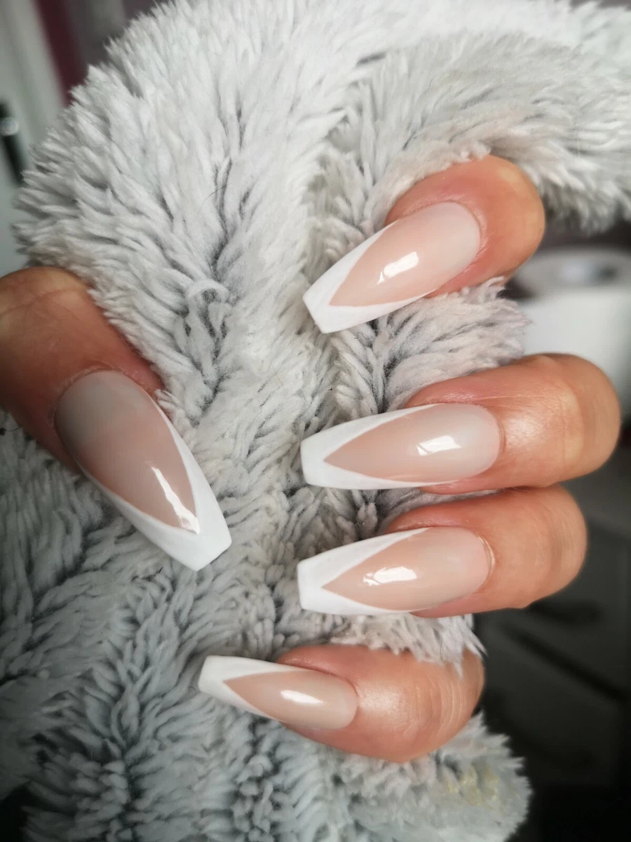 Share more than 137 baby's nails have ridges best ceg.edu.vn