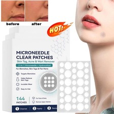 1 3BOX Curalona Microneedle Patches 144pcs, Skin Tag Wart Acne Remover Patches