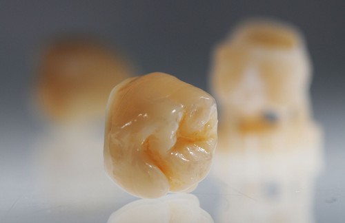 VarseoSmile Crown Plus by BEGO- Druk 3D Żywica dentystyczna - Korony trwałe 250g - Zdjęcie 5 z 6