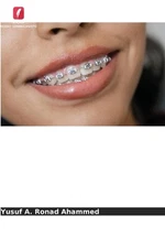 Avanos nos materiais ortodnticos by Yusuf A. Ronad Ahammed (Portuguese) Paperbac