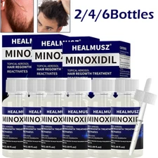 Extra Strength 5% Minoxidil Hair Regrowth Treatment Serum for Men & Women