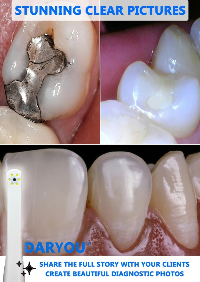 Cámara intraoral DARYOU DY-50 cámara dental, botón trabajo en Dexis, Eaglesoft más - Imagen 2 de 4