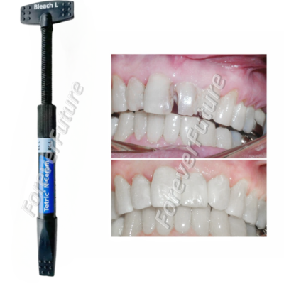 #ad #ad Dental Tetric N Ceram Composite Resin Bleach Light Whitening Veneer BLL 3.5g Pcs $295.66