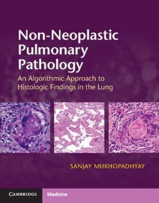 Nicht-neoplastische Lungenpathologie mit Online-Ressource An Algori... 9781107443501