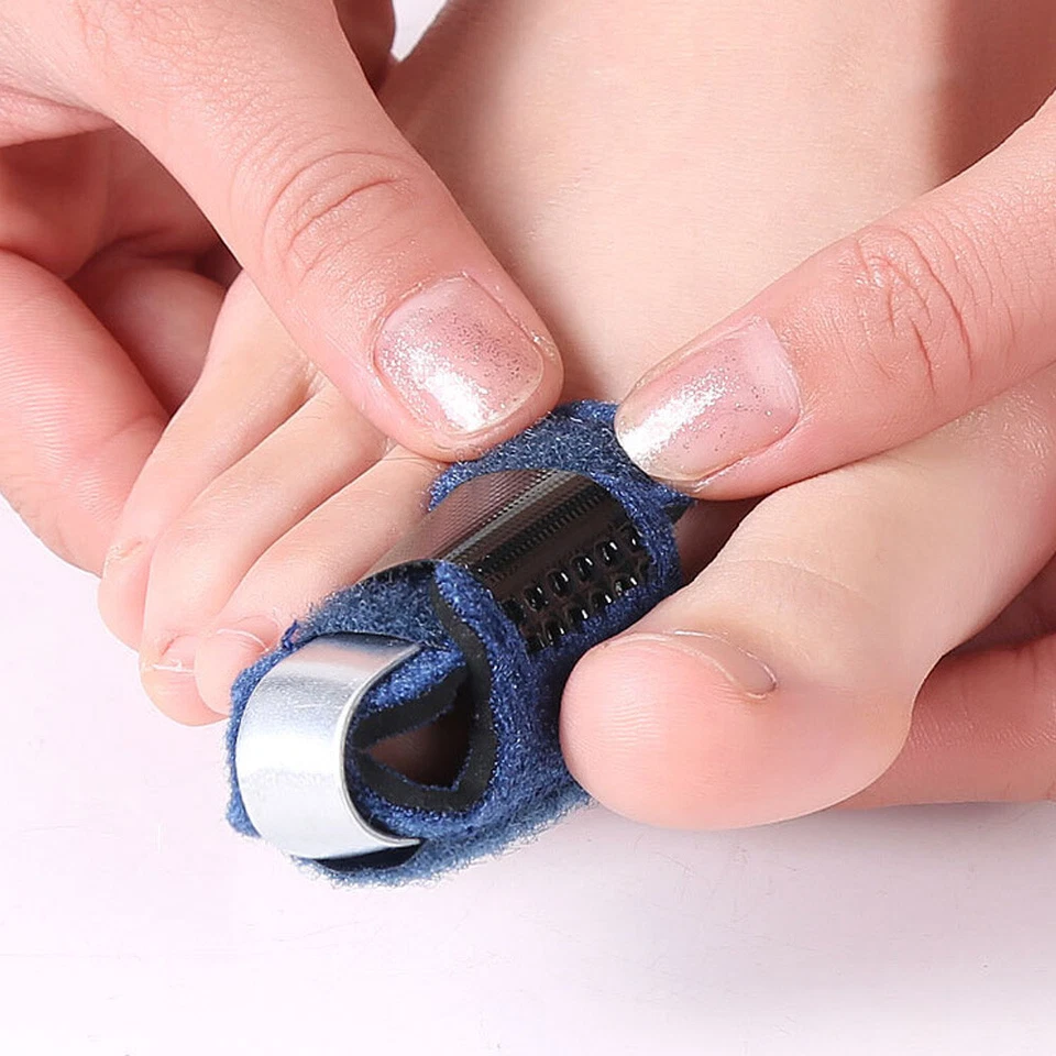 Toe Fixing Splint Straighten Brace Adjustable Fracture Fibger Splint Corrector - Image 3 of 4