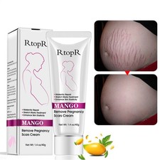 40g Mango Remove Pregnancy Scars Cream Stretch Marks Treatment Repair